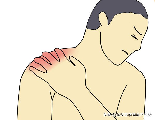 肩周炎怎么办,一文详解肩周炎的治疗方法